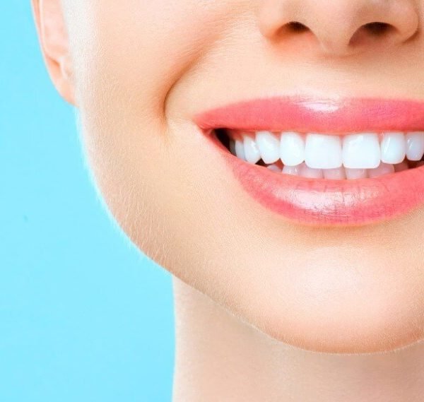Teeth Whitening Is Best Done At A Canberra Dental Care Clinic