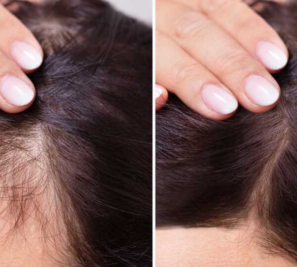 Hair Transplant Clinic