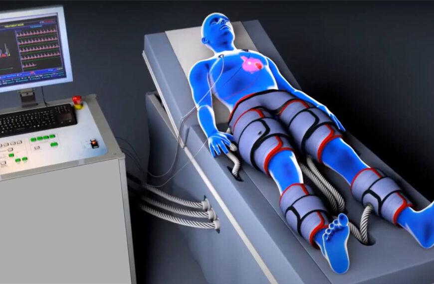Benefits of EECP Over Bypass Surgery