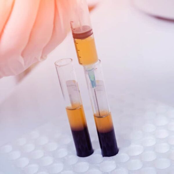 Biolife Handle Plasma Donations